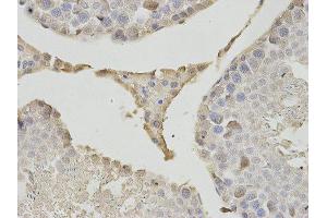 Immunohistochemistry (IHC) image for anti-Proteasome (Prosome, Macropain) Subunit, beta Type, 1 (PSMB1) antibody (ABIN1875399) (PSMB1 anticorps)