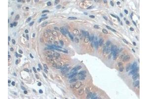 Detection of IL22Ra2 in Mouse Uterus Tissue using Polyclonal Antibody to Interleukin 22 Receptor Alpha 2 (IL22Ra2) (IL22RA2 anticorps  (AA 31-223))