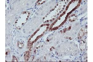 Image no. 2 for anti-Interferon Regulatory Factor 6 (IRF6) antibody (ABIN1498901)