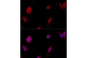 Confocal immunofluorescence analysis of U-2OS cells using PTBP1 antibody  at dilution of 1:50.
