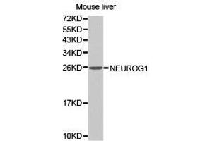 Western Blotting (WB) image for anti-Neurogenin 1 (NEUROG1) antibody (ABIN1873884) (Neurogenin 1 anticorps)