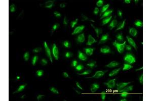Immunofluorescence of monoclonal antibody to NME2 on HeLa cell.