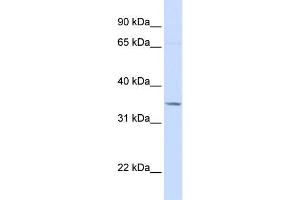 WB Suggested Anti-TOLLIP Antibody Titration: 0. (TOLLIP anticorps  (C-Term))