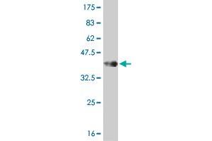Western Blot detection against Immunogen (35. (PDK3 anticorps  (AA 174-263))