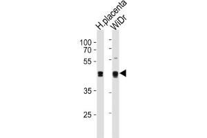 Western Blotting (WB) image for anti-SAP30 Binding Protein (SAP30BP) antibody (ABIN3004651) (SAP30BP anticorps)