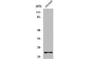 Western Blot analysis of A549 cells using Rho D Polyclonal Antibody