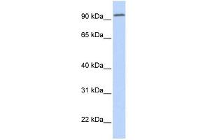 DPP6 antibody used at 1 ug/ml to detect target protein. (DPP6 anticorps  (Middle Region))