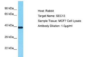 Host: Rabbit Target Name: SEC13 Sample Type: MCF7 Whole Cell lysates Antibody Dilution: 1. (SEC13 anticorps  (Middle Region))
