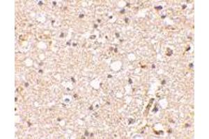 Immunohistochemical staining of human brain tissue using GRIK1 polyclonal antibody  at 2. (GRIK1 anticorps  (Internal Region))