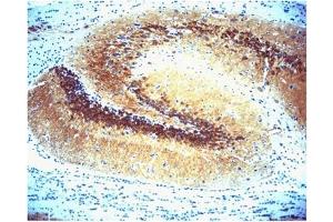 Immunohistochemistry (IHC) image for anti-Calcium/calmodulin-Dependent Protein Kinase II alpha (CAMK2A) (AA 448-460) antibody (ABIN968458)