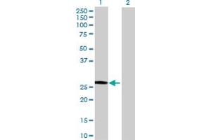 Western Blot analysis of SART3 expression in transfected 293T cell line