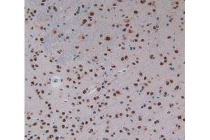 IHC-P analysis of Mouse Brain Tissue, with DAB staining. (KHDRBS1 anticorps  (AA 156-381))