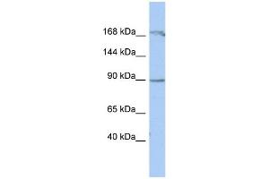 WB Suggested Anti-NARG1 Antibody Titration:  0. (NAA15 anticorps  (Middle Region))