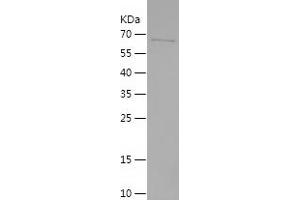 Western Blotting (WB) image for Androgen Receptor (AR) (AA 551-919) protein (His-IF2DI Tag) (ABIN7121826)