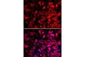 Immunofluorescence analysis of U2OS cells using QARS antibody (ABIN5974184). (QARS anticorps)