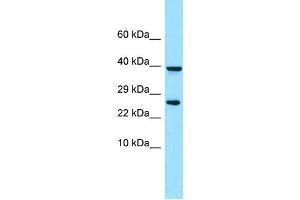 WB Suggested Anti-PDGFRL Antibody Titration: 1. (PDGFRL anticorps  (N-Term))