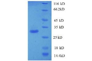 SDS-PAGE (SDS) image for phosphatidylserine Synthase 1 (PTDSS1) (AA 1-35), (partial) protein (GST tag) (ABIN1047515)