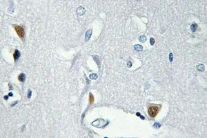 Immunohistochemistry (IHC) analyzes of p-Histone H2A. (H2AFX anticorps  (pSer139))