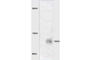 Lane 1: mouse brain lysates Lane 2: mouse embryo lysates probed with Anti LRIG1 Polyclonal Antibody, Unconjugated (ABIN735263) at 1:200 in 4 °C. (Lrig1 anticorps  (AA 1001-1093))