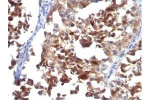 Image no. 2 for anti-CD63 (CD63) antibody (ABIN6187977) (CD63 anticorps)