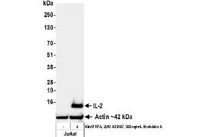 Western Blotting (WB) image for anti-Interleukin 2 (IL2) (AA 21-153) antibody (ABIN7795689)