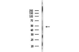 Western blot analysis of lysates from MCF7 cells(heat-shock,45 min treatment), using EDNRA Antibody at 1/1000 dilution.