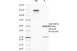 SDS-PAGE Analysis Purified CD104 Mouse Monoclonal Antibody (UMA9). (Integrin beta 4 anticorps)