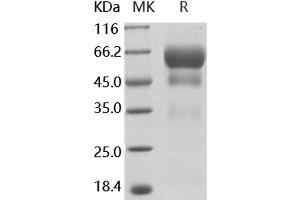 Western Blotting (WB) image for Prosaposin (PSAP) protein (His tag) (ABIN7317152) (Prosaposin Protein (PSAP) (His tag))
