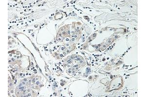 Image no. 4 for anti-Intercellular Adhesion Molecule 1 (ICAM1) antibody (ABIN465661) (ICAM1 anticorps)