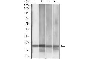 Western blot analysis using MGMT mouse mAb against MCF-7 (1), Jurkat (2), HepG2 (3), and PC-3 (4) cell lysate. (MGMT anticorps  (AA 32-210))