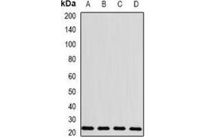 Western blot analysis of BLVRB expression in MCF7 (A), HepG2 (B), mouse spleen (C), rat liver (D) whole cell lysates. (BLVRB anticorps)