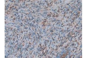 Detection of S100A6 in Rat Uterus Tissue using Polyclonal Antibody to S100 Calcium Binding Protein A6 (S100A6)