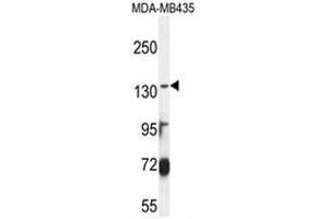 ABCC3 Antibody (Center) western blot analysis in MDA-MB435 cell line lysates (35 µg/lane). (ABCC3 anticorps  (Middle Region))