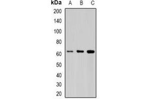Western blot analysis of STIP1 expression in Hela (A), COS7 (B), mouse brain (C) whole cell lysates.