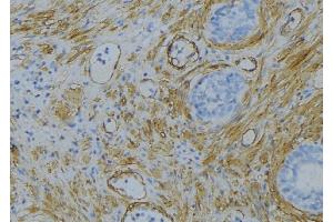 ABIN6274689 at 1/100 staining Human uterus tissue by IHC-P. (Laminin beta 1 anticorps  (C-Term))