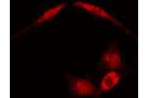 ABIN6274147 staining COLO205 cells by IF/ICC.