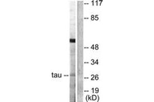 Western blot analysis of extracts from HeLa cells, using 14-3-3 thet/tau (Ab-232) Antibody. (14-3-3 theta anticorps  (AA 196-245))
