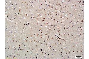 Formalin-fixed and paraffin embedded human brain labeled with Anti-HDAC8 Polyclonal Antibody, Unconjugated (ABIN681268) at 1:200 followed by conjugation to the secondary antibody and DAB staining (HDAC8 anticorps  (AA 151-250))