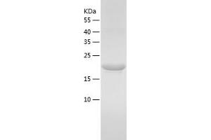 Western Blotting (WB) image for Fibroblast Growth Factor 4 (FGF4) (AA 25-206) protein (His tag) (ABIN7122942) (FGF4 Protein (AA 25-206) (His tag))