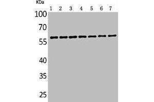 Western Blot analysis of customer's sample using ALPP/ALPPL2 Polyclonal Antibody.