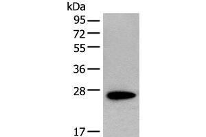 Western blot analysis of NIH/3T3 cell lysate using CD63 Polyclonal Antibody at dilution of 1:250 (CD63 anticorps)