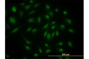Immunofluorescence of monoclonal antibody to SKP1A on HeLa cell. (SKP1 anticorps  (AA 53-160))
