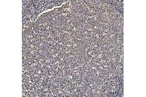 IHC analysis of HOXC4 using anti-HOXC4 antibody (ABIN7603059). (HOXC4 anticorps  (Middle Region))