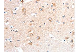 The image on the left is immunohistochemistry of paraffin-embedded Human brain tissue using ABIN7128440(ANXA8 Antibody) at dilution 1/25, on the right is treated with fusion protein. (Annexin VIII anticorps)