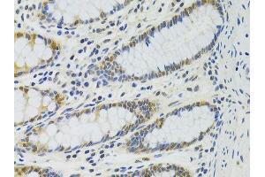 Immunohistochemistry of paraffin-embedded human colon using PPP4C antibody.