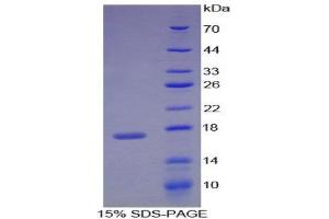 SDS-PAGE (SDS) image for Retinol Binding Protein 1, Cellular (RBP1) (AA 2-135) protein (His tag) (ABIN2122009)
