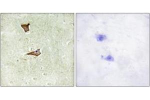 Immunohistochemistry analysis of paraffin-embedded human brain, using IGF2R (Phospho-Ser2409) Antibody.