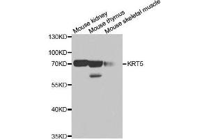 Western blot analysis of extracts of various cell lines, using KRT5 antibody. (Cytokeratin 5 anticorps)