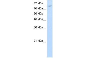 WB Suggested Anti-MCM7 Antibody Titration:  1. (MCM7 anticorps  (Middle Region))