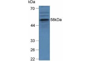 Detection of GBA in Human hepG2 Cells using Polyclonal Antibody to Glucocerebrosidase (GBA) (GBA anticorps  (AA 255-509))